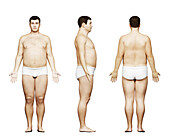 Overweight male body, illustration