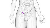 Female appendix, illustration