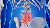 Male lumbar spine, illustration