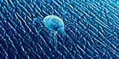 Tick on human skin, illustration