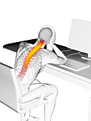 Office worker with backache, illustration