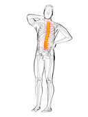 Man's painful back, illustration