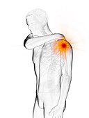 Man with a painful shoulder joint, illustration