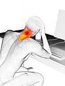 Man in an office with a painful neck, illustration