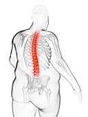 Obese man's painful back, illustration