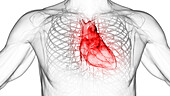 Inflamed heart, illustration
