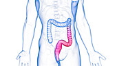 Ulcerative colitis, illustration