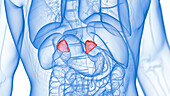 Inflamed adrenal gland, illustration