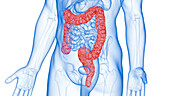 Inflamed colon, illustration