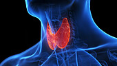 Inflamed thyroid gland, illustration