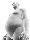 Obese male body, illustration