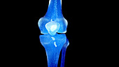 Skeletal knee, illustration