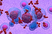 Multiple myeloma cell emitting paraprotein, illustration