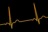 Healthy heartbeat rhythm, illustration