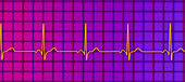 Healthy heartbeat rhythm, illustration