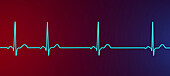 Sinus arrhythmia heartbeat rhythm, illustration