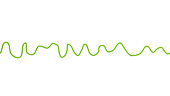 Ventricular fibrillation heartbeat rhythm, illustration