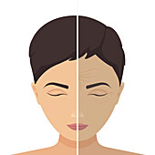 Beauty treatment before and after, illustration