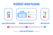 Platelet rich plasma procedure, conceptual illustration