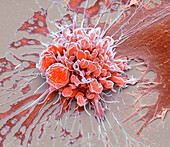 Chemotherapy induced cell death, SEM