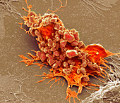 Chemotherapy induced cell death, SEM