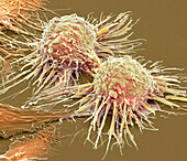 Dividing HeLa cells, SEM