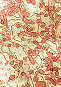 Mitochondrial section, TEM