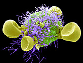 Respiratory Syncytial Virus, SEM