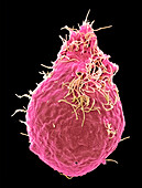 Respiratory Syncytial Virus, SEM