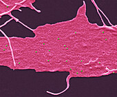 Adenovirus, SEM