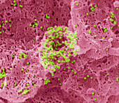 Adenovirus, SEM