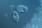 Vorticella similis protozoa, light micrograph