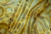 Scytonema algae, light micrograph