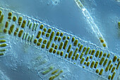 Fragilaria islandica algae, light micrograph