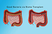 Unhealthy and healthy bacteria in the intestine, illustration
