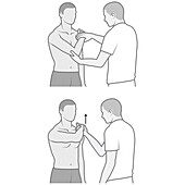 Shoulder examination, illustration