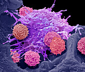 (CAR) T-cell therapy, SEM