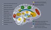 Brain activity during REM sleep, illustration