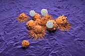 T cells attacking kidney cancer cells, illustration