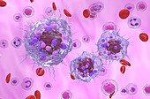 Neuroendocrine tumour cells, illustration