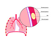 Pleura anatomy, illustration