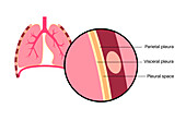 Pleura anatomy, illustration