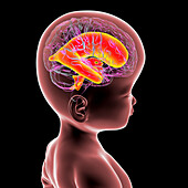 Baby with enlarged brain ventricles, illustration