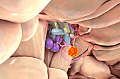 Pituitary gland tumour, illustration