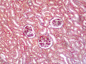 Human kidney, light micrograph