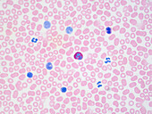 Blood cells, light micrograph