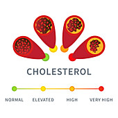 Cholesterol levels, conceptual illustration