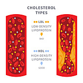 Cholesterol levels, conceptual illustration