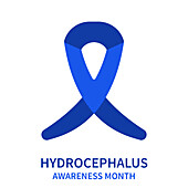 Hydrocephalus, conceptual illustration