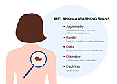 Melanoma warning signs, illustration